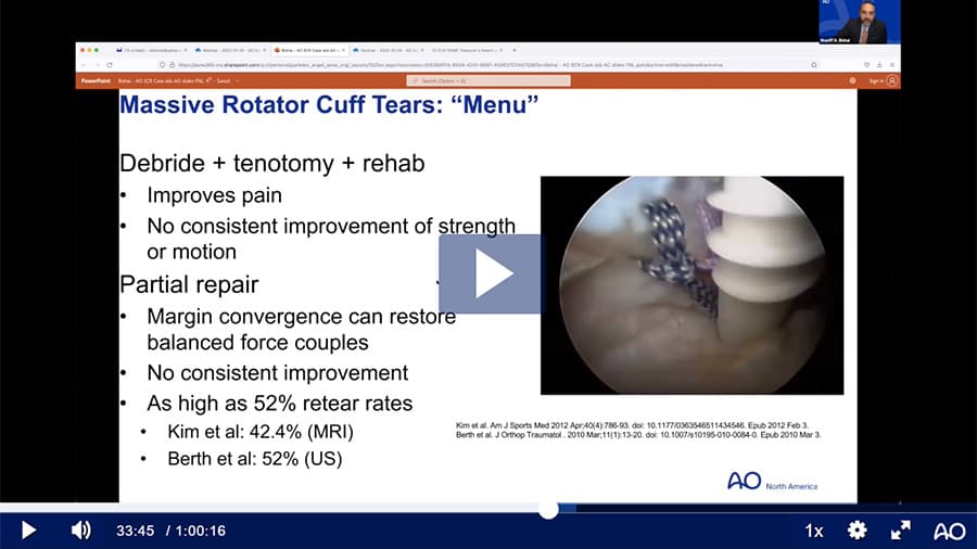 AO Sports Webinar—How I Treat a Massive Rotator Cuff Tear