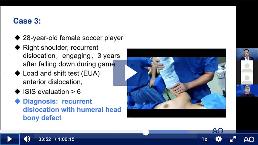 AO Sports Webinar—Arthroscopic Management of Glenohumeral Instability (English)