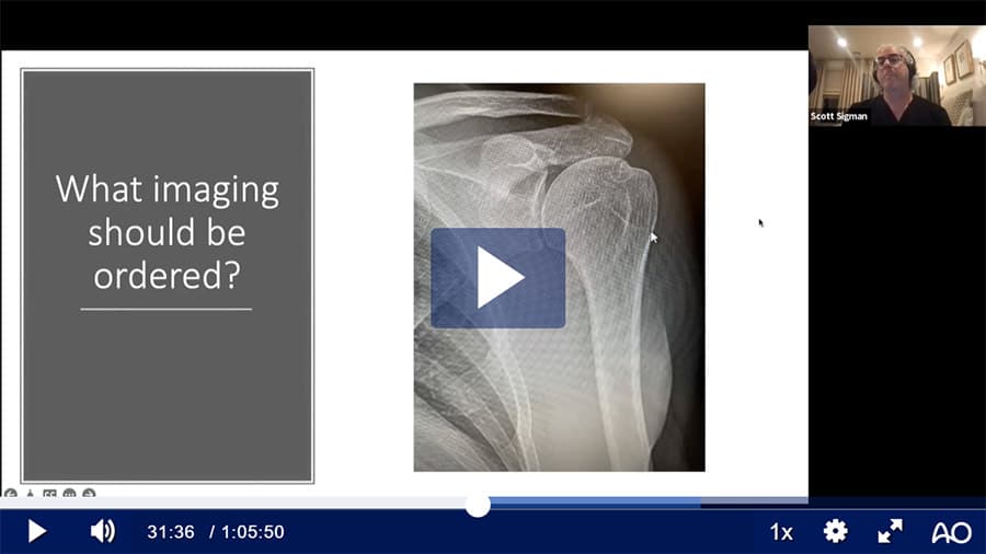 Failed Rotator Cuff Repair