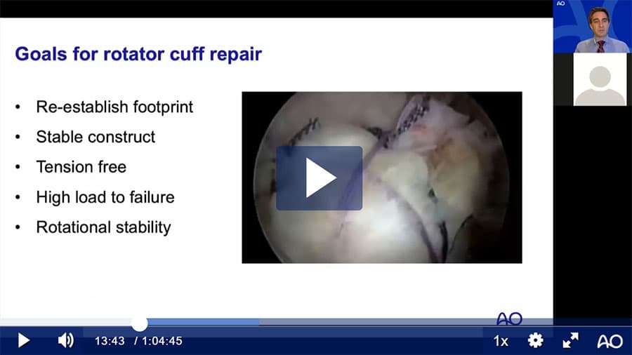 AO Sports Webinar—Arthroscopic Management of Rotator Cuff Tears