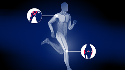 AO Sports NA Principles of Sports Medicine—the Joint Is an Organ