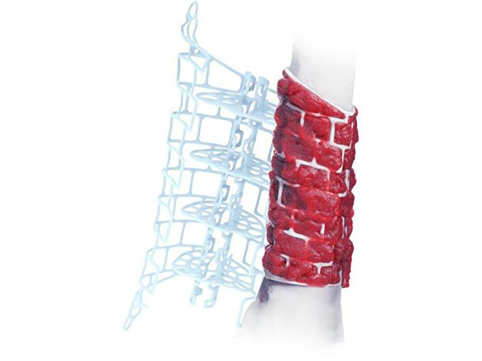 Salvin Osseous Coagulum Trap With 3 Single Use Filters