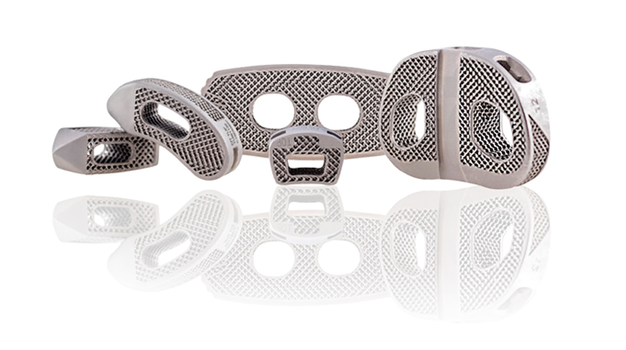 Conduit™ Interbody Platform