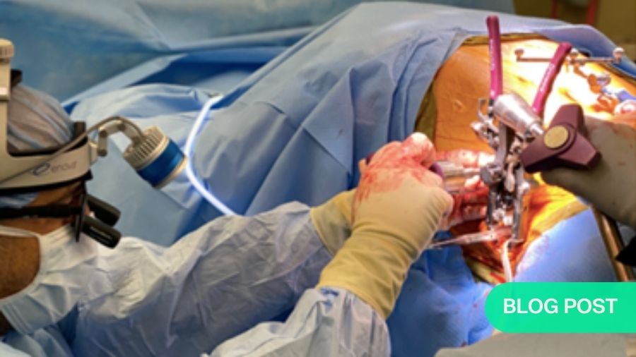 Lumbar Single Position Surgery (LSPS): optimized way for